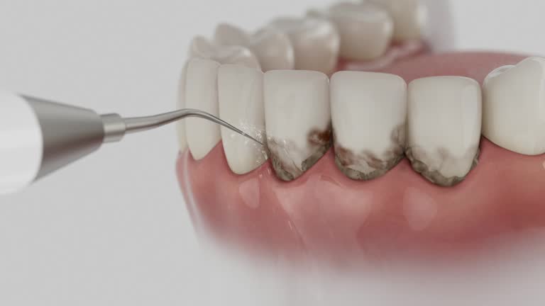 Reliable Dental Implants contractor in Forest, MS by Smile Center Dentistry